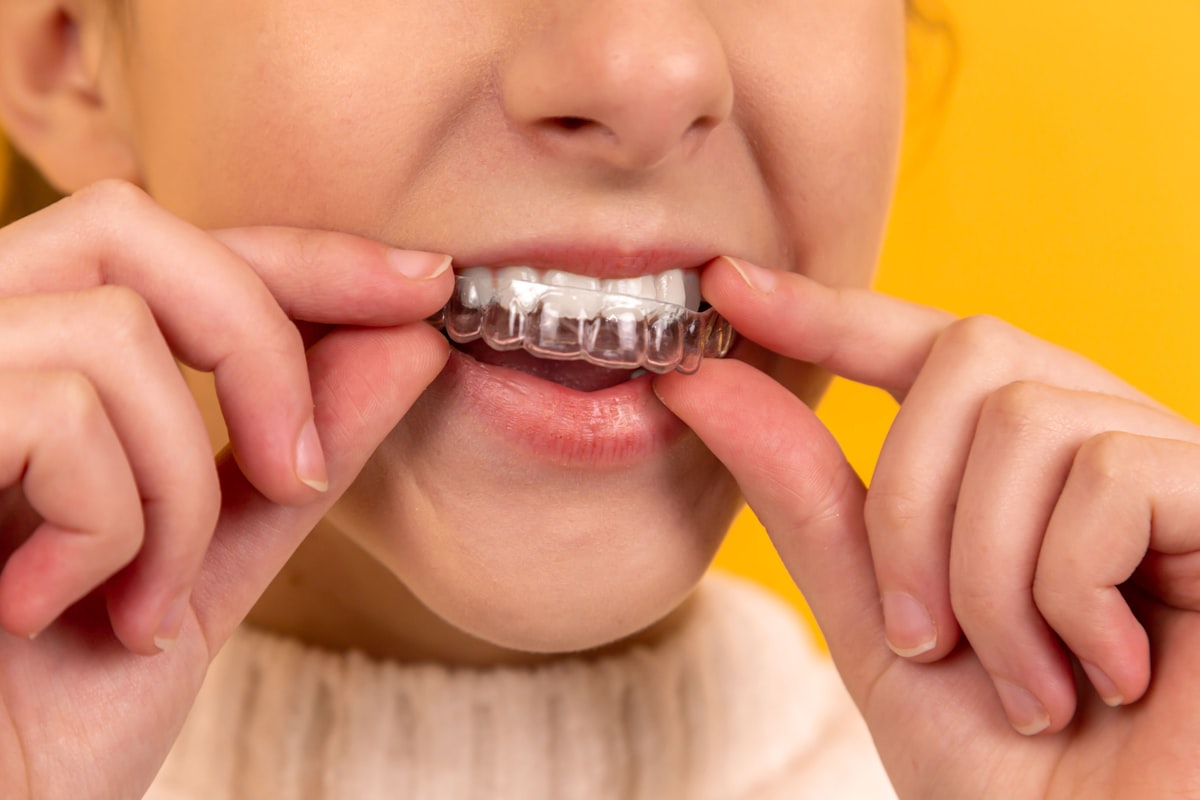 Progettazione digitale del sorriso