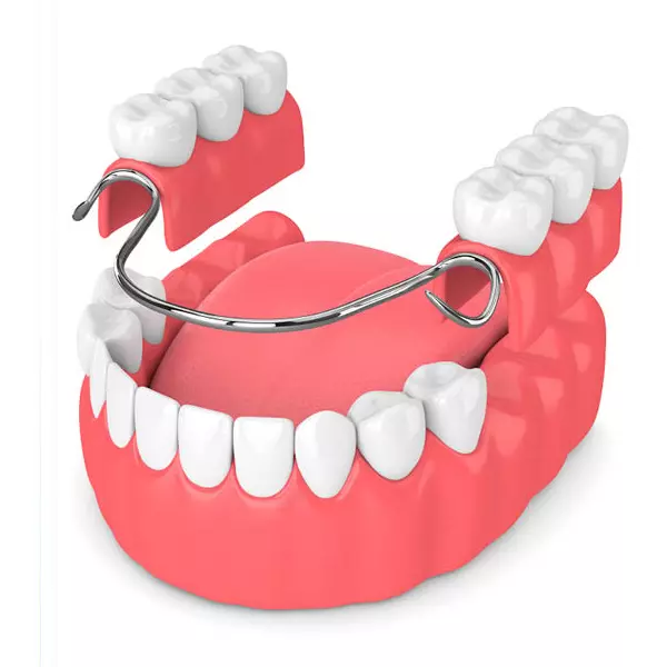 servizio_Protesi mobile