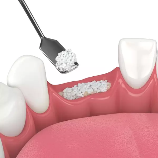 servizio_Ricostruzione Ossea