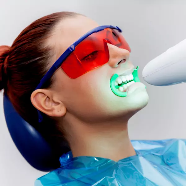 servizio_Sbiancamento dei denti
